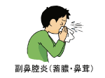 副鼻腔炎（蓄膿・鼻茸）